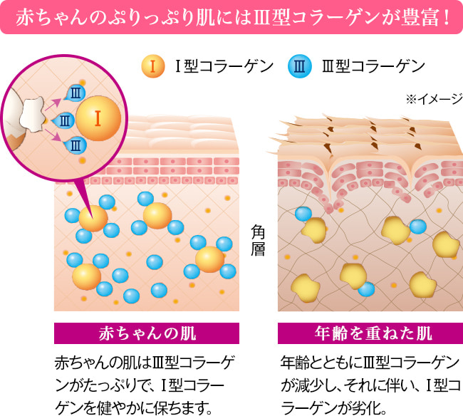 赤ちゃんのぷりっぷり肌にはⅢ型コラーゲンが豊富！