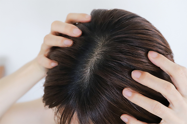 頭皮が乾燥する原因や悪化する行動とは？乾燥を防ぐ対策方法を解説