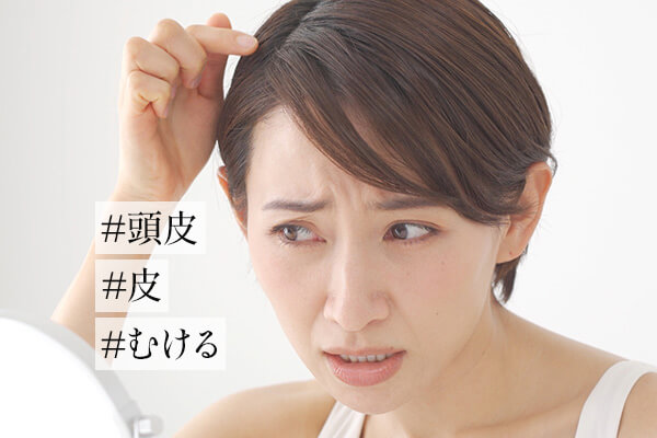 頭皮の皮がむける原因と対処法｜フケはなぜ出る？