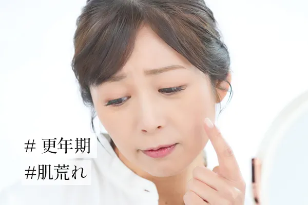 更年期に肌荒れは起こりやすい？肌トラブルへの対処法を紹介
