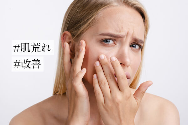 肌荒れ改善のために意識したい5つのポイント・具体的な改善方法