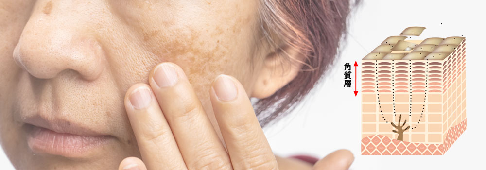 50代の肌悩みに多いくすみとは？