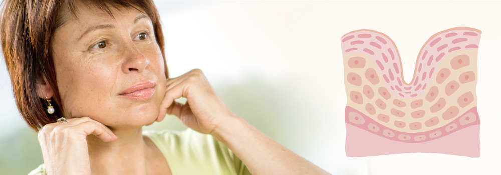 50代の顔のたるみの代表的な原因