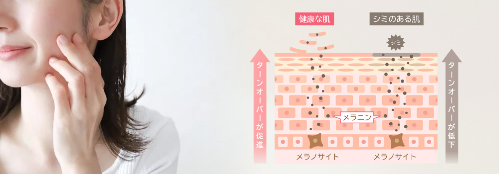 シミ対策の基本！シミの原因は？