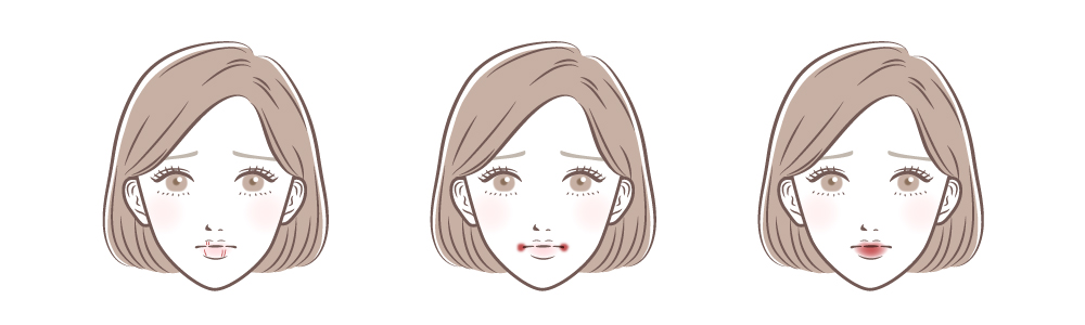 乾燥した唇の一般的な症状