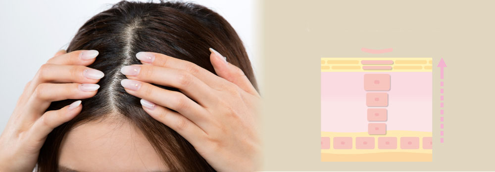 頭皮の皮がむけるプロセスとは？