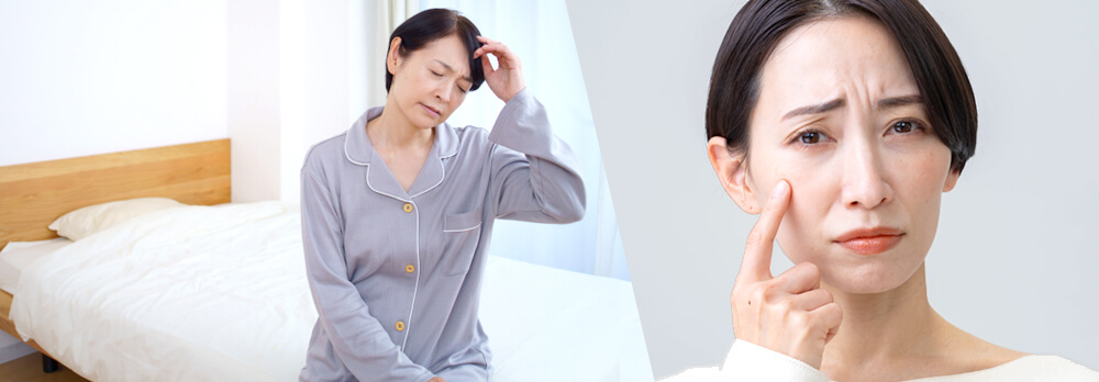 更年期に肌荒れが起こる原因