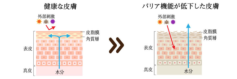 花粉によって肌荒れが起こる理由